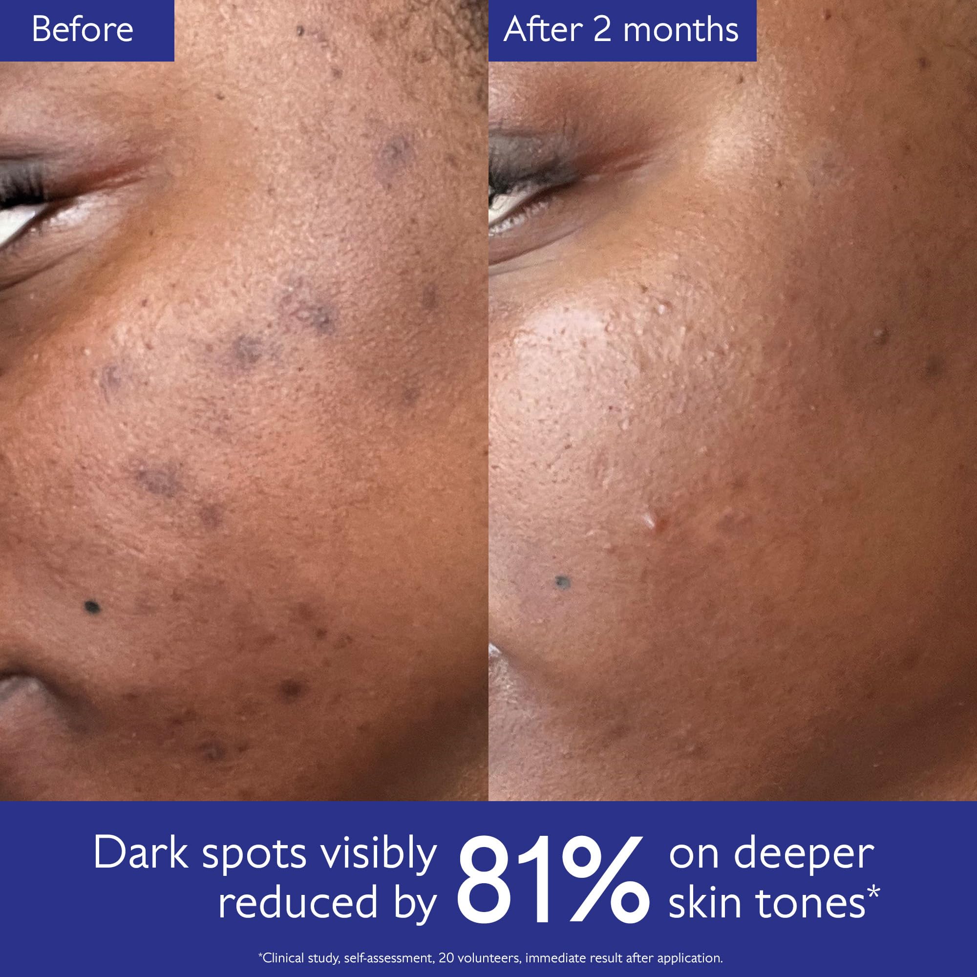 Caudalie Vinoperfect Radiance Serum with Natural Viniferine – Brightening Face Serum, 50 mL